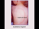 https://image.noelshack.com/minis/2018/19/3/1525823212-lyme.png