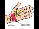 https://www.noelshack.com/2018-21-7-1527441715-nerf-median-poignet-canal-carpien-schema.jpg