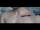 https://image.noelshack.com/fichiers/2018/32/1/1533525865-clavicule3.png
