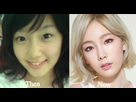 https://image.noelshack.com/fichiers/2018/35/3/1535555497-taeyeon-plastic-surgery-taeyeon-plastic-surgery-before-and-after-photos-taeyeon-snsd-nose-job-before-and-after-1.jpg