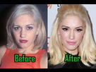 https://image.noelshack.com/fichiers/2019/26/5/1561674922-gwen-stefani-plastic-surgery-1.jpg