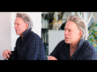 https://www.noelshack.com/2019-27-5-1562325272-mickey-rourke-cara-operaciones-1555336619.jpg