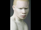https://image.noelshack.com/fichiers/2019/35/5/1567177759-albinos.jpg