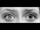 https://image.noelshack.com/fichiers/2019/47/7/1574604083-dilated-vs-contracted-pupils.jpg