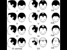 https://image.noelshack.com/fichiers/2020/10/1/1583183011-partial-norwood-scale-for-male-pattern-baldness.png