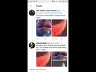 https://image.noelshack.com/fichiers/2020/17/1/1587371781-screenshot-20200420-103534-twitter.jpg