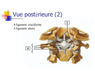 1587632283-vue-posterieure-2-4-ligament-