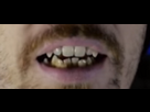 https://image.noelshack.com/fichiers/2020/20/2/1589299914-goji-dent.png