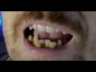 https://image.noelshack.com/fichiers/2020/20/2/1589299980-goji-dent-2.png