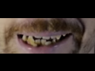 https://image.noelshack.com/fichiers/2020/20/2/1589300022-goji-dent-1.png