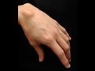 https://image.noelshack.com/fichiers/2020/23/6/1591460664-kyste-synovial-poignet.jpg