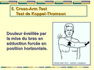 https://image.noelshack.com/fichiers/2020/34/2/1597759361-epaule-00062.png