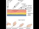 https://image.noelshack.com/fichiers/2021/11/6/1616264941-needle-insertion-angles-1.png