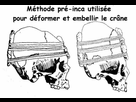 https://image.noelshack.com/fichiers/2021/13/6/1617458777-cranedeformemethode.jpg