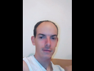 https://image.noelshack.com/fichiers/2021/17/4/1619684861-1521384263-calvitie-010181.jpg