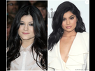 https://image.noelshack.com/fichiers/2021/23/1/1623100845-2230663-kylie-jenner-avant-et-apres-la-chirurgie-950x0-1.jpg