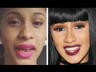 https://image.noelshack.com/fichiers/2021/33/2/1629236634-cardi-b-teeth-before-and-after.jpg