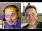 https://image.noelshack.com/fichiers/2021/38/5/1632465965-elon-musk-avant-apres-le-resultat-de-la-greffe-de-cheveux.jpg