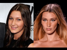 https://image.noelshack.com/fichiers/2021/38/6/1632579261-bella-hadid-before-and-after-plastic-surgery-1500-1000.jpg