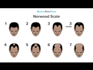 https://image.noelshack.com/fichiers/2021/52/3/1640746275-an-infographic-of-the-norwood-scale.jpg