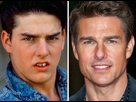 https://image.noelshack.com/fichiers/2022/06/6/1644637798-tom-cruise-chirurgie-esthetique-des-dents.jpg