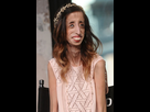 https://image.noelshack.com/fichiers/2022/22/5/1654263180-lizzie-velasquez-1.jpg