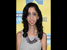 https://image.noelshack.com/fichiers/2022/23/7/1655035085-lizzie-velasquez.jpg