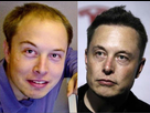 https://image.noelshack.com/fichiers/2022/25/7/1656269104-elon-musks-hair-transplant.jpg