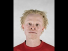 https://image.noelshack.com/fichiers/2022/29/4/1658415725-mar06-albino-african-americans-240x300.jpg
