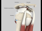 https://image.noelshack.com/fichiers/2022/34/1/1661149396-acromioplastie-1.jpg