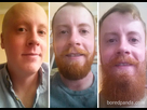 https://image.noelshack.com/fichiers/2022/35/6/1662216479-before-after-growing-beard-no-shave-november-23-5a0d66a695506-700.jpg