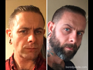 https://image.noelshack.com/fichiers/2022/35/6/1662216539-before-after-growing-beard-no-shave-november-14-5a0d52cc072aa-700.jpg