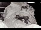 https://image.noelshack.com/fichiers/2022/37/6/1663447249-1464962040-dr-leonid-rogozov-operating-himself-to-remove-his-appendix-in-antarctica-1961-2.jpg