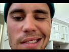 https://image.noelshack.com/fichiers/2022/39/2/1664263056-1536315-justin-bieber-est-atteint-du-syndrome-de-ramsey-hunt.jpeg