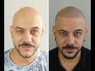 https://image.noelshack.com/fichiers/2022/41/5/1665757731-micropigmentation-cheveux-toulouse-paris-marseille.jpg