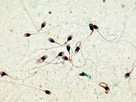 https://image.noelshack.com/fichiers/2022/43/1/1666640545-cover-r4x3w1200-58de3df957cec-spermatozoi-des.jpg