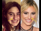 https://image.noelshack.com/fichiers/2022/44/7/1667753035-lele-pons-nose-job.jpg