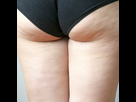 https://image.noelshack.com/fichiers/2022/51/3/1671630658-cellulite-comment-s-en-debarrasser-en-5-etapes.jpeg