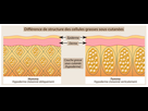 https://image.noelshack.com/fichiers/2022/52/1/1672065286-cellules-graisseuses-sous-cutanees.jpg