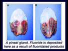 https://image.noelshack.com/fichiers/2023/01/4/1672931546-pineal-fluoride.jpg