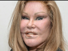 https://image.noelshack.com/fichiers/2023/07/6/1676752250-jocelyn-wildenstein-la-femme-chat-totalement-ruinee.jpg