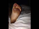 https://image.noelshack.com/minis/2023/09/4/1677774587-my-kids-feet-even-after.png