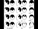 https://www.noelshack.com/2023-19-1-1683539863-partial-norwood-scale-for-male-pattern-baldness-1024x975.png