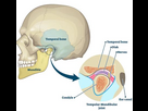 https://image.noelshack.com/fichiers/2023/35/6/1693664477-temporomandibular-joint-disorders-tmjd-and-bruxism.jpg