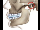 https://image.noelshack.com/fichiers/2023/35/6/1693664506-articulacion-temporomandibular.jpg