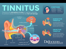 https://image.noelshack.com/fichiers/2023/35/6/1693665185-tinnitus-symptoms-causes-and-natural-support-strategies.jpg