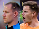 https://image.noelshack.com/fichiers/2023/37/7/1694936920-ter-stegen-hair-transplant-before-and-after-side-angle.jpg