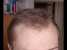 https://image.noelshack.com/fichiers/2023/39/3/1695773710-img-20230915-213405.jpg