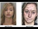 https://image.noelshack.com/fichiers/2023/45/4/1699487344-heroin-before-and-after-picture.jpg
