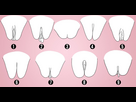 https://image.noelshack.com/fichiers/2024/01/1/1735592309-les-9-differents-types-de-vagin-guide-complet-2023-1200x628.jpg